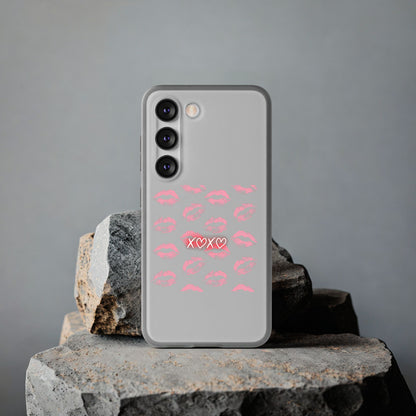 Kiss Print Phone Case - Stylish Flexi Case, Cute Phone Cover, Gift for Her, Trendy Accessories, Valentine's Day, Romantic Style