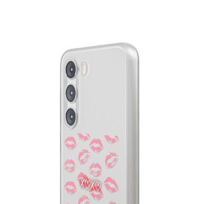 Kiss Print Phone Case - Stylish Flexi Case, Cute Phone Cover, Gift for Her, Trendy Accessories, Valentine's Day, Romantic Style