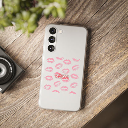 Kiss Print Phone Case - Stylish Flexi Case, Cute Phone Cover, Gift for Her, Trendy Accessories, Valentine's Day, Romantic Style