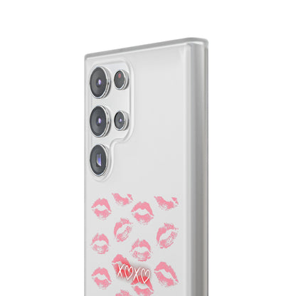 Kiss Print Phone Case - Stylish Flexi Case, Cute Phone Cover, Gift for Her, Trendy Accessories, Valentine's Day, Romantic Style