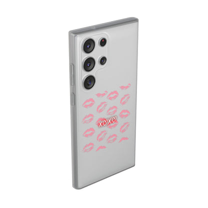 Kiss Print Phone Case - Stylish Flexi Case, Cute Phone Cover, Gift for Her, Trendy Accessories, Valentine's Day, Romantic Style