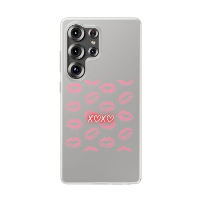 Kiss Print Phone Case - Stylish Flexi Case, Cute Phone Cover, Gift for Her, Trendy Accessories, Valentine's Day, Romantic Style