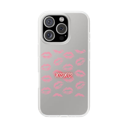 Kiss Print Phone Case - Stylish Flexi Case, Cute Phone Cover, Gift for Her, Trendy Accessories, Valentine's Day, Romantic Style